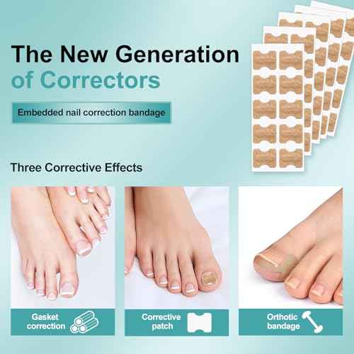 Ingrown Toenail Corrector Set with Correction Strips, Professional Ingrown Toenails Pedicure Tool Set, Painless File and Lifter Pedicure Tools Pedicure Tools,Ingrown Nail Tool for Women Man(1 Count)