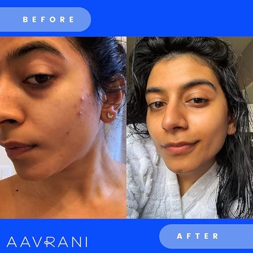 AAVRANI Glow Activating Exfoliator ? Stain-Free Turmeric Face Mask with Aloe, JoJoba, Shea, Lavender and Neem ? Exfoliating Clay Mask for Acne, Dark Spots, and Deep Pore Cleansing, 1.7 Fl Oz (New)