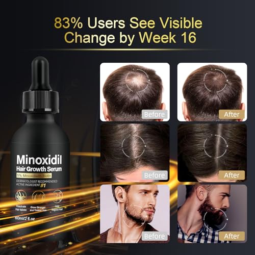 5% Minoxidil Hair Growth Serum for Men and Women - Thicker, Fuller Hair