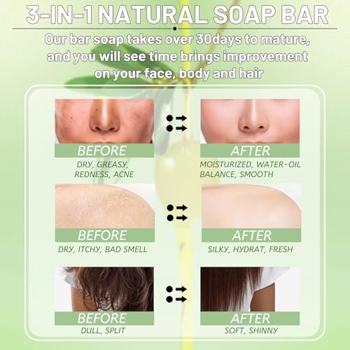 5 Pack Olive Oil Soap Bar, Organic and Natural Soap Handmade with 80% Olive Oil 20% Laurel, Cold Pressed Bar Moisturize and Soothe Itchy for Face, Body and Hair, Fragrance Free, 3.53 oz