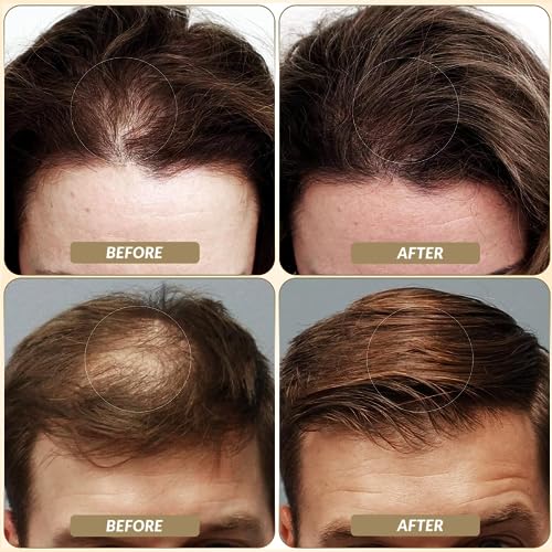 SOVONCARE Hair Fibers for Thinning Hair, Black 28g