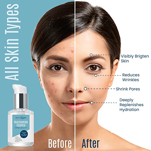 Niacinamide Serum Skin Balancing, Restores Elasticity. (2 FL OZ)