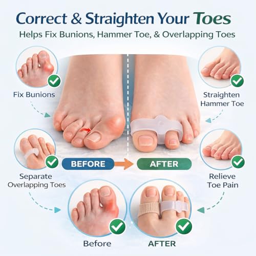 Bunion Corrector Toe Separators 4-Piece Set for Men & Women, Big Toe Spacers for Pain Relief