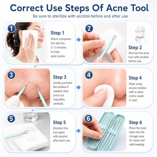MENOLY 10-Piece Blackhead Remover Tool Kit with Anti-Slip Handle