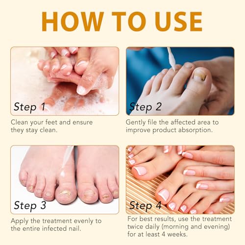 Ginger Nail Growth Serum - 60ml Strengthener Oil