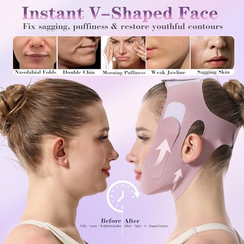 PeaKalo Lilac Graphene V-Line Chin Strap for Face Lifting & Double Chin Reduction