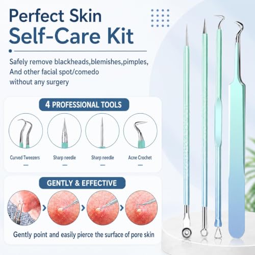 MENOLY 10-Piece Blackhead Remover Tool Kit with Anti-Slip Handle