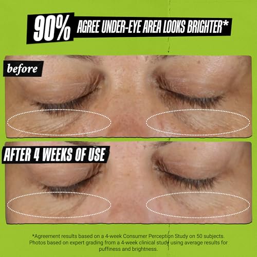 Kiehl's Avocado Eye Treatment, Under Eye Cream for Puffiness and Dark Circles, with Caffeine to Correct Bags, 99% Naturally Derived Non-Toxic Formula