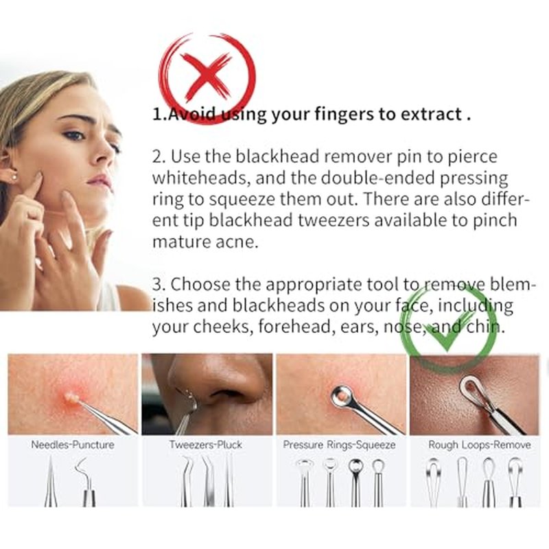 22-Piece Professional Blackhead Remover Kit - YOUYISI Pimple Popper Tools