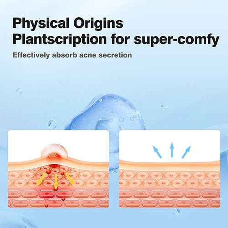 Pimple Patches for Face, Colorful Hydrocolloid Acne Patches, Cute Star Zit Covers for Face, Spot Stickers with Tea Tree, Salicylic Acid & Cica Oil| 4 Sizes (8mm, 10mm, 12mm & 14mm) |357 Count