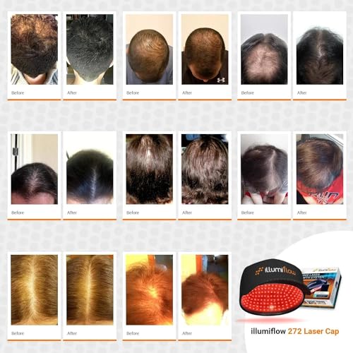 illumiflow 272 Laser Cap for Hair Growth - FDA Cleared LLLT
