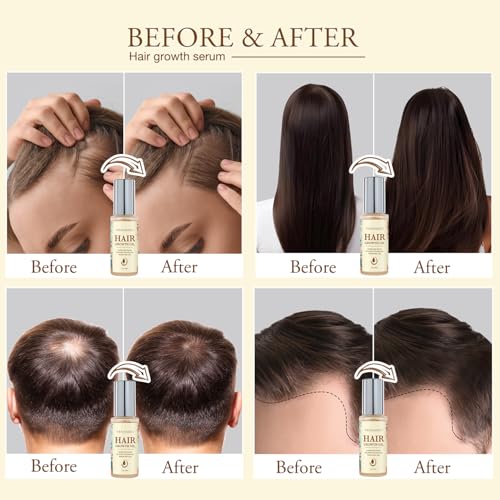 Hair Growth Oil with Biotin & Rosemary – Nourishing Serum for Thicker, Fuller Hair
