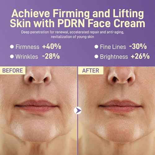 PDRN Anti-Aging Face Moisturizers Cream with 5% Squalane,100% Pure PDRN Salmon DNA,Hyaluronic Acid & B5, Firming, Hydrating, Moisturizing Repair Face & Neck Skinare Cream for All Skin,1.85 Fl Oz