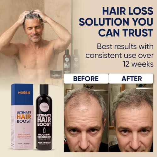 Moerie Hair Growth Conditioner for Men and Women – Biotin & Rosemary Thickening Solution