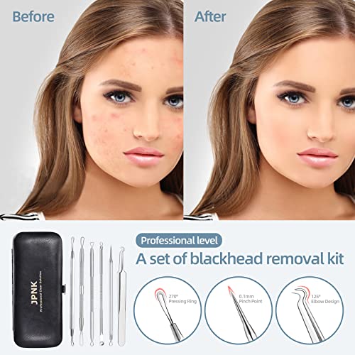 JPNK Silver Blackhead Remover Kit - Comedone Extractor for Acne & Blemishes