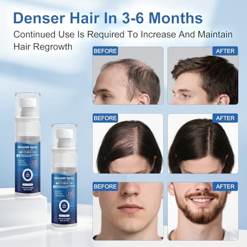 5% Minoxidil Spray for Hair & Beard Growth - 7 Bottles