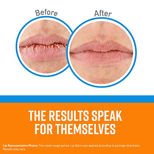 O'Keeffe's Cooling Relief Lip Repair Lip Balm for Dry, Cracked Lips, Stick, (Pack of 10)