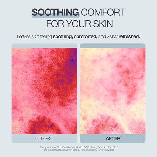 POESIA EGF Cooling + Recovery Sheet Mask Set ? -8¡ÆC Instant Chill | Korean Pore-Refining Face Mask with Allantoin, Witch Hazel & Ceramides | 5 Sheets | Soothes, Brightens, Tightens