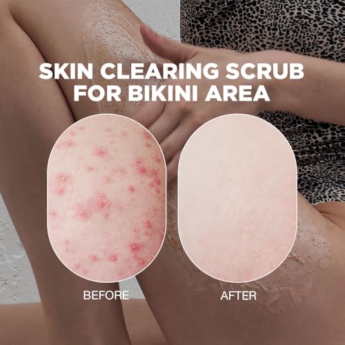 Bikini Exfoliating Scrub | Advanced Exfoliating Scrub For Bikini Area | Bikini Scrub Exfoliator For Intimate Area | Bikini Bumps Treatment For Women | Bikini Exfoliating Scrub for Intensive Skincare