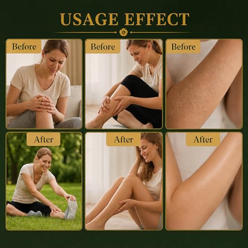 SOEYOM Miracle Balm for Varicose Veins & Muscle Relief - 1.76oz