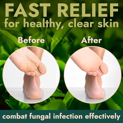 Terramed Exfoliating Foot Scrub with Tea Tree Oil & Callus Remover