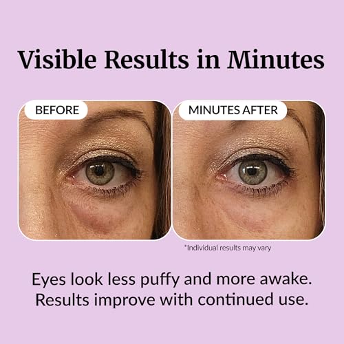 Vibriance Eye Renewal Serum for Mature Skin