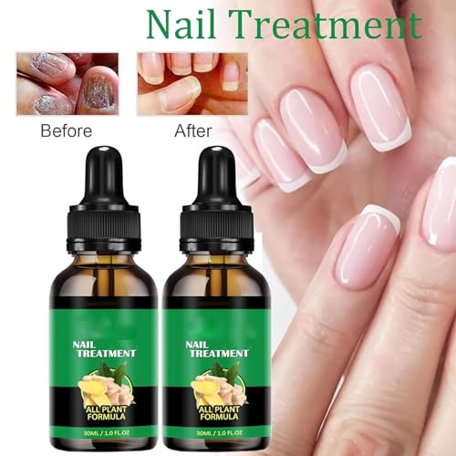 Ginger Nail Growth Serum - Strengthening Nail Repair Oil
