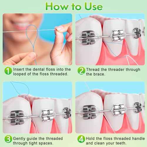 Floss Threaders, Orthodontic Threader, Ultraclean Access Tool for Maintaining Oral Health with Braces, Bridges, and Implants 500 Count (5Pack)