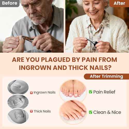 LIONVISON Ingrown Toenail Removal Kit: 8 Pcs Professional Toenail Clippers for Thick Toenails - Heavy Duty Nail Clippers Tools for Seniors Home Foot Care