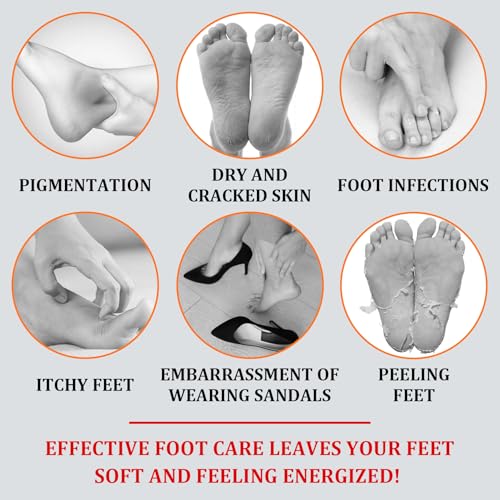 Orange Oil Exfoliating Foot Peeling Spray - Dead Skin & Callus Remover