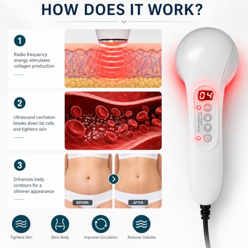 RF Cellulite Reduction Device | Portable Home Beauty Machine
