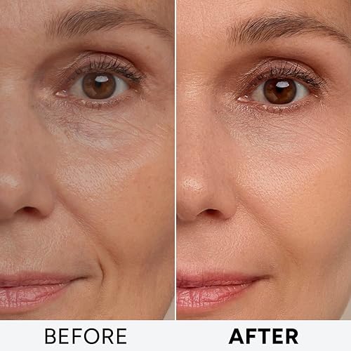 Retinol Cream for Face with Collagen and Hyaluronic Acid - Anti Aging Wrinkle Cream for Women and Men - Day and Night Facial Moisturizer for Tightening and Skin Firming - Crema Hidratante Para la Cara