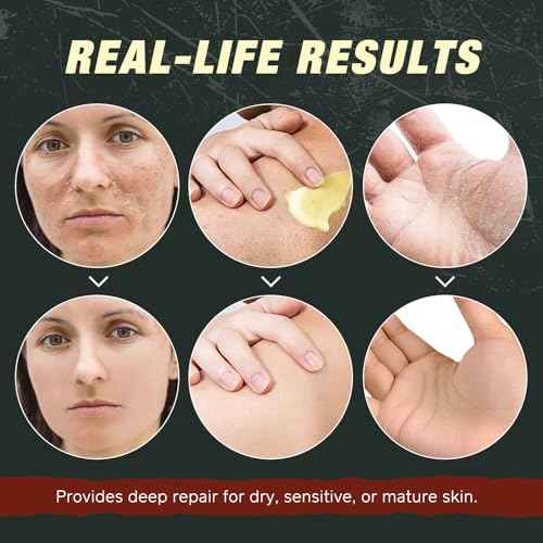 Beef Tallow Balm with Frankincense and Castor oil 4.2 fl.oz, 100% Grass-Fed Tallow for Skin Care, Face & Body Moisturizer for Skin Hydrating & Nourishing, Sensitive Skin & Dry Skin Age Defying