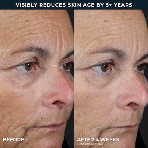 RoC Retinol Correxion 2-Step Peel Pads - 20 Treatments