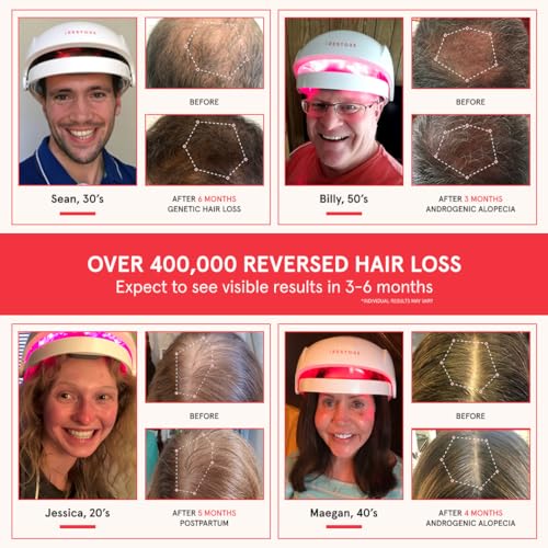 iRestore Laser Hair Growth Cap - FDA-Cleared Therapy for Thinning Hair