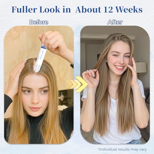 Rosemary Hair Growth Serum Roll On - Thicker Fuller Hair for Men & Women