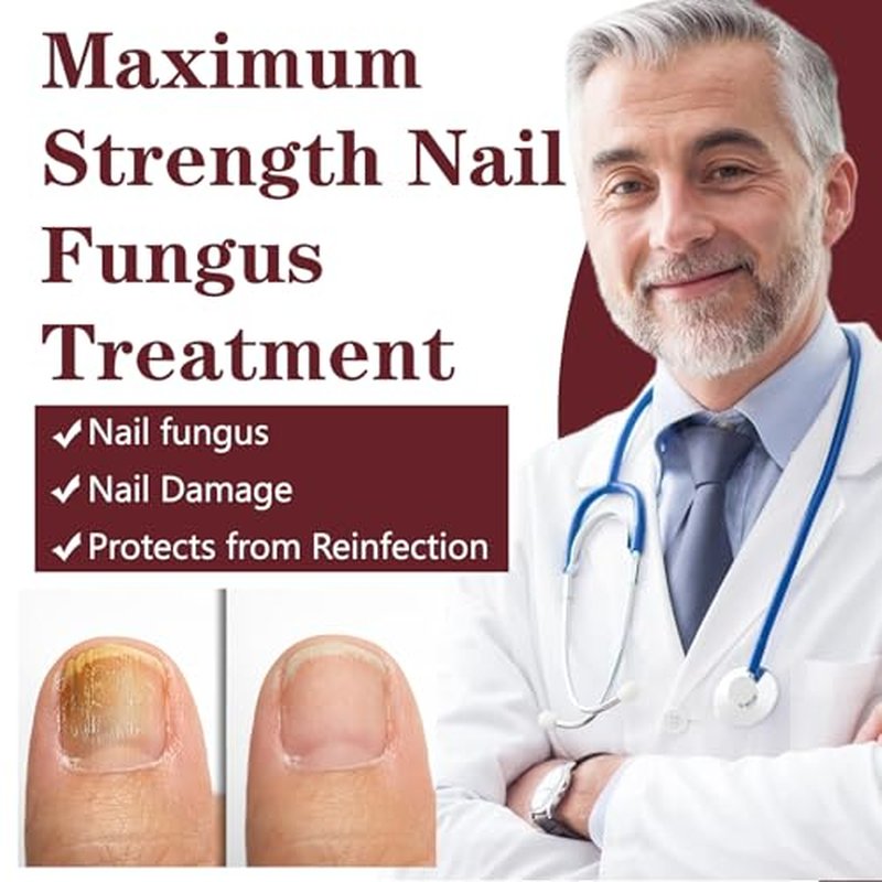 Extra Strength Toenail Fungus Treatment with 25% Undecylenic Acid