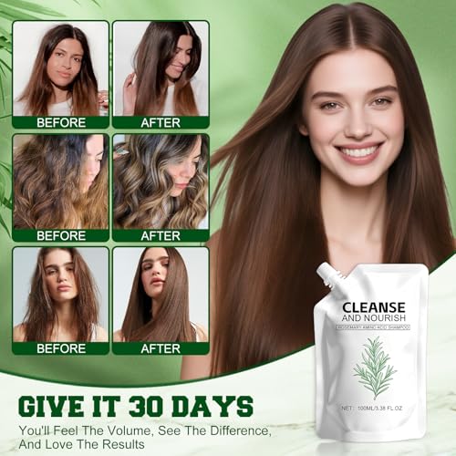 Rosemary Amino Acid Shampoo for Hair Loss & Growth