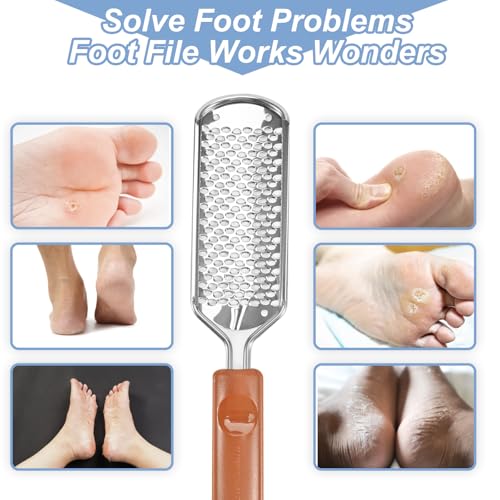 Pedicure Foot File Callus Remover T1 Foot Scrubber for Cracked Heels - Untrytb