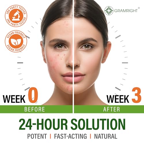 Acne Face Cream - Acne Spot Treatment for Face & Acne Dots - Tea Tree Oil & Salicylic Acid - Natural Cystic Acne Treatment - Made in USA - For All Skin Types - Acne Scar Cream & Pimple Remover 4 fl.oz