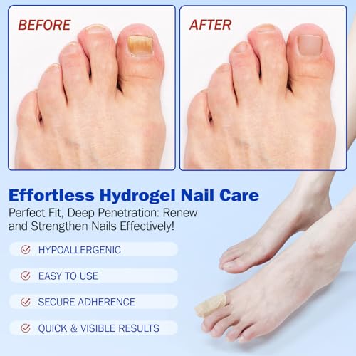 Overnight Hydrogel Nail Repair Patches for Brittle & Cracked Nails (21 Pcs)