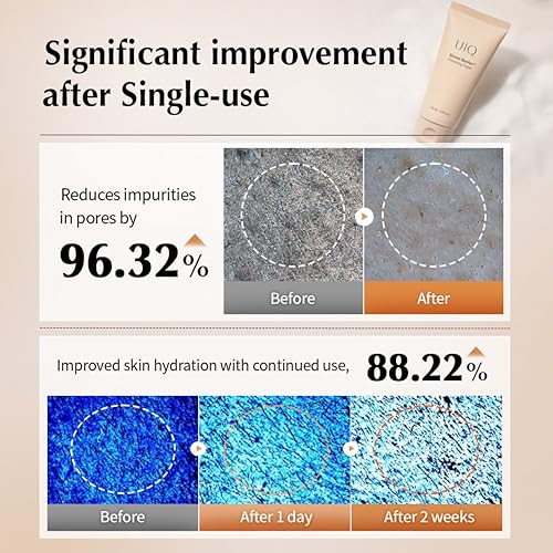 UIQ Biome Barrier Cleansing Foam for Sensitive Skin 120ml - Low pH, Hydrating & Deep Pore Cleanser