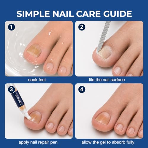 Nail Fungus Pen Treatment for Toenails & Fingernails, 4 Count