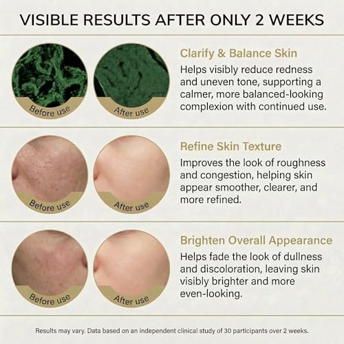 Azelaic Acid Serum with Niacinamide & Vitamin C ? Brightens Dark Spots, Reduces Redness, Helps Clear Acne Marks, Calms Sensitive Skin ? Lightweight Facial Serum
