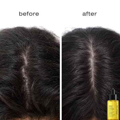 shu uemura art of hair Essence Absolue Pre-Shampoo & Nourishing Treatment Oil - Soothes Dry and Flaky Scalp, Leaves Scalp Moisturized and Balanced, Nourishes For Soft and Shiny Hair, 1.7 Fl Oz