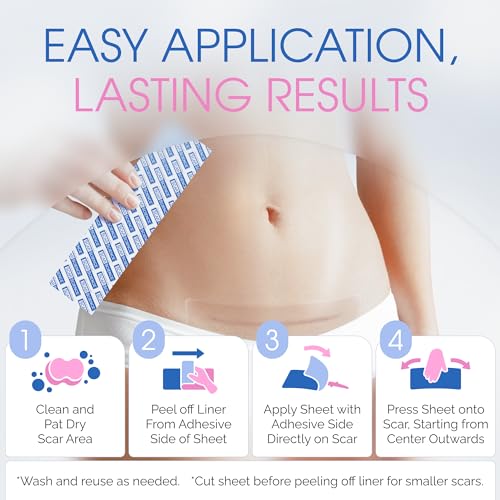 C-Section Silicone Scar Sheets for Cesarean Incision Scars ? Medical Grade Reusable Silicone Scar Strips for Postpartum Recovery ? Clear Breathable Silicone Tape - 7¡±, 8-Pack