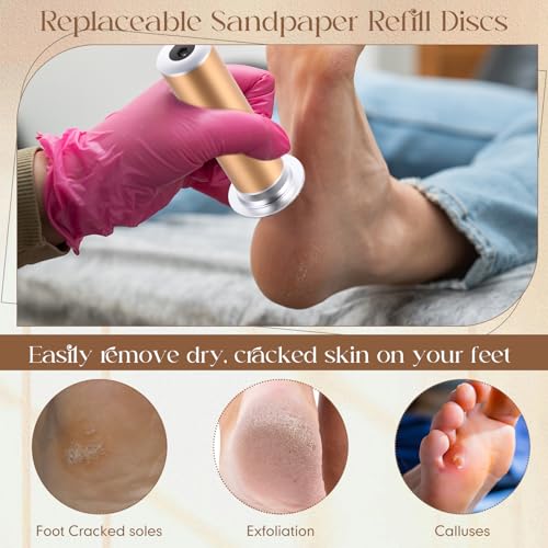 Gisafai 1000 Pcs Replaceable Sandpaper Refill Discs Bulk 80 Grit Replacement Sandpaper Pad Discs for Electric Foot File Callus Remover Black Tool Foot File Disks for Cracked Heels Dead Skin