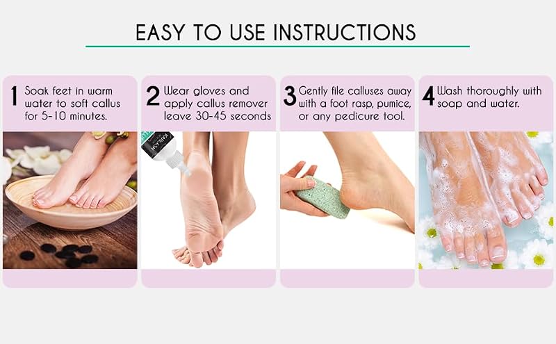 Karlash Professional Callus Remover Gel & Pumice Stone Kit - 4 oz