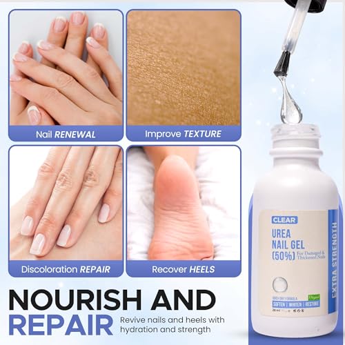Blue Urea 50% Nail Gel for Cracked Heels & Thick Toenails - Soften & Restore
