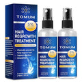 5% Minoxidil Spray Hair Growth Treatment for Men & Women 60ml